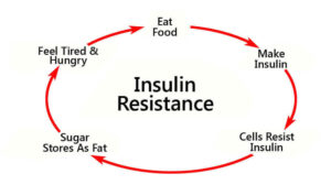 InsulinResistanceImage